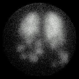 match_vent1.gif (20226 bytes)