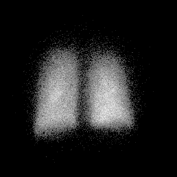 norm_perf.gif (12668 bytes)