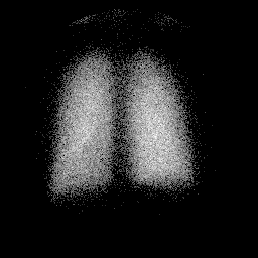 norm_vent.gif (11969 bytes)