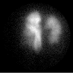 perfusion1.gif (8591 bytes)