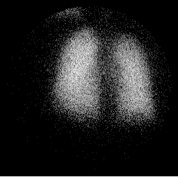 vent1.gif (8676 bytes)